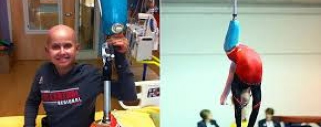 “Young Gymnast Overcomes all the Odds”